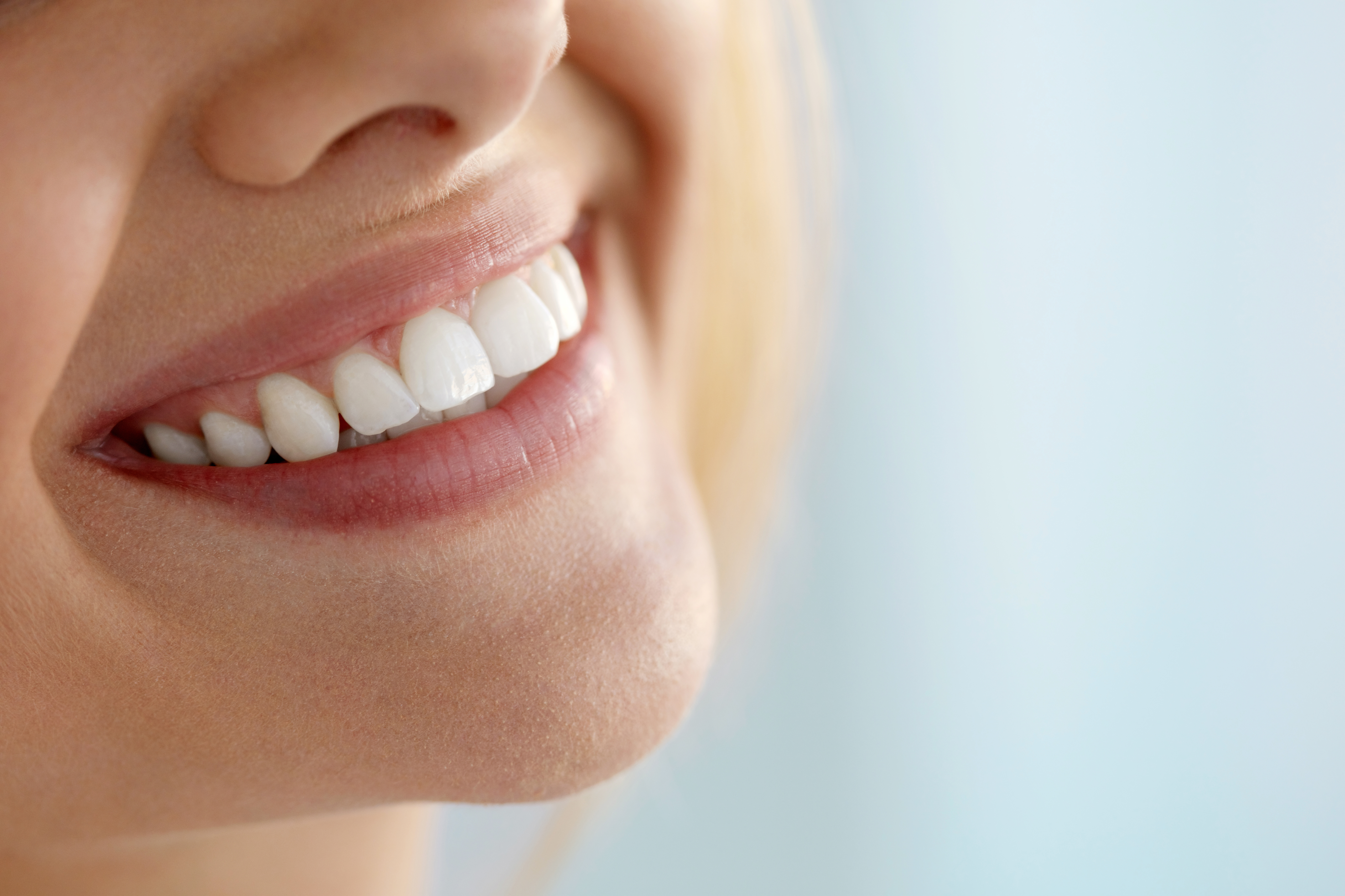 malattie del parodonto | closeup di sorriso